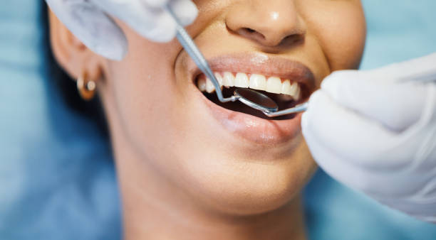 Best Emergency Dental Extractions in Benld, IL